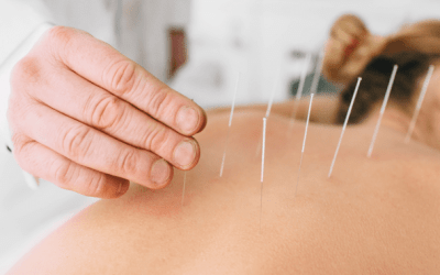 Beneficios de la acupuntura en el deporte